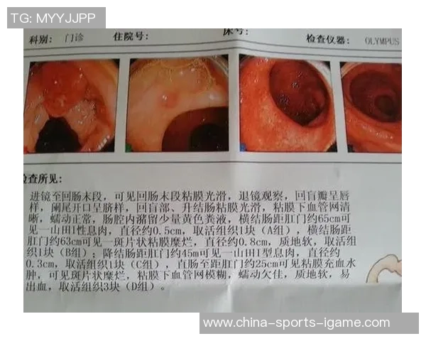 篮球明星勇敢抗癌之路揭示肠癌早期症状与预防方法的重要性